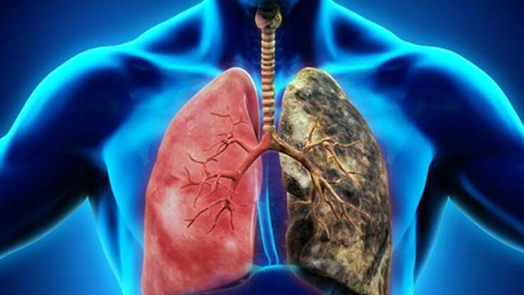 Akciğer Kanserinde Kemoterapi İhtiyacı Azalıyor