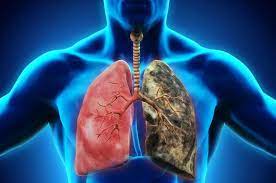 Veremin belirtileri nedir?