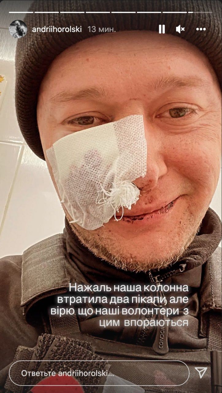 Orduya katılan Ukraynalı müzisyen, Rus saldırılarında yaralandı