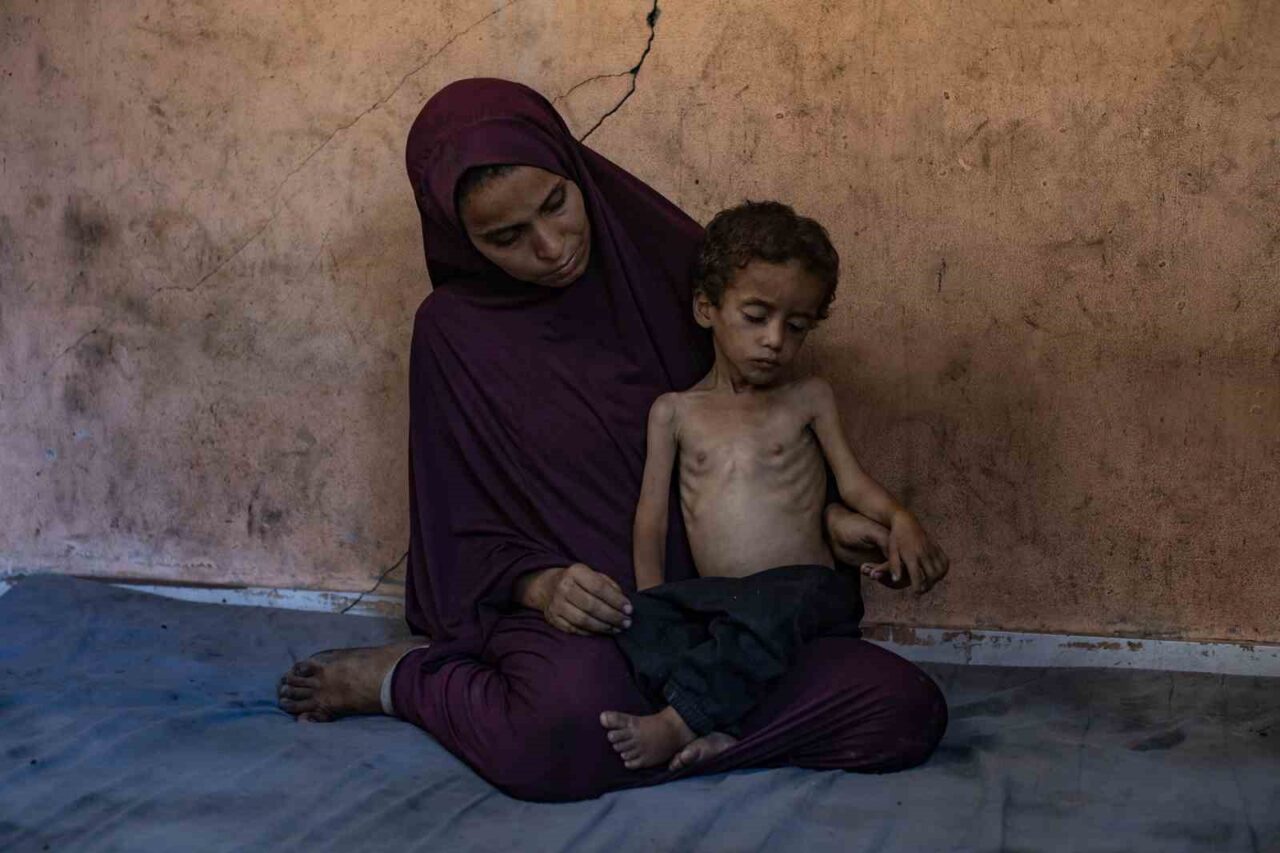 Gazze’de açlık nedeniyle hayatını kaybedenlerin sayısı 113’e yükseldi