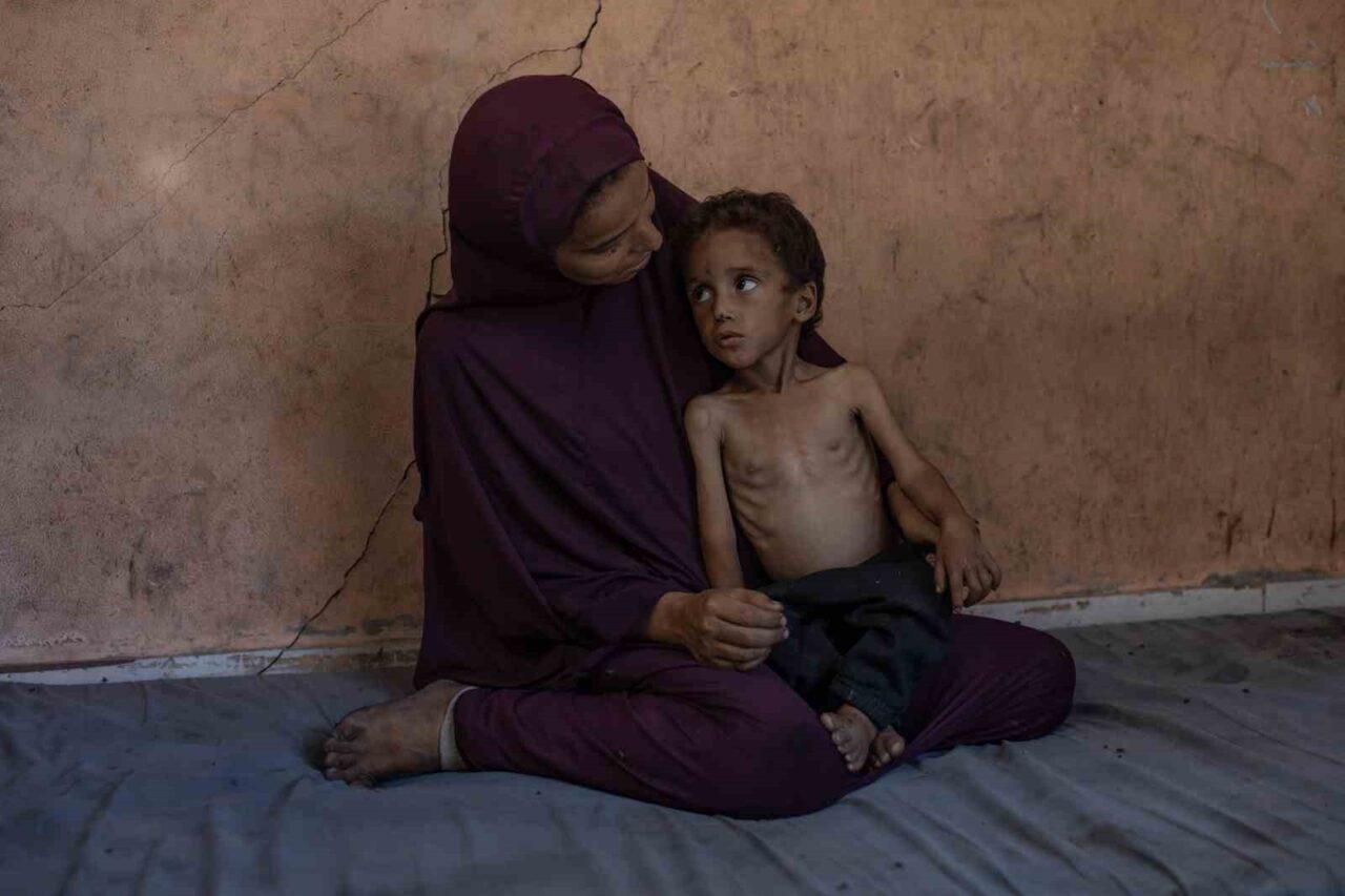 Gazze’de açlık nedeniyle hayatını kaybedenlerin sayısı 127’ye yükseldi