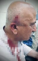 Kerkük’te kaçak yapı yıkımı sırasında kaymakama bıçaklı ve sopalı saldırı